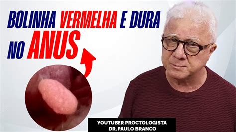 sangue no anus
